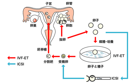 女方有遗传病可以借卵子吗_新加坡试管婴儿解决你的生育难题